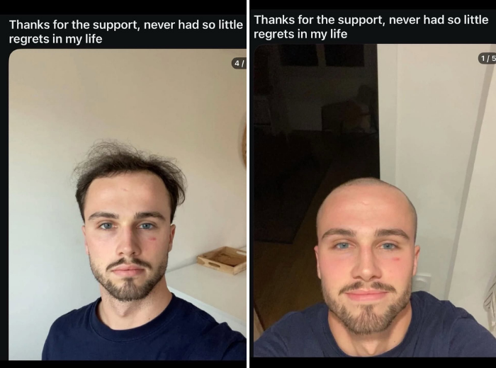 Viral Bald